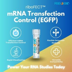 Product image for riboFECT mRNA Transfection Control featuring a sample tube and four key features: efficient transfection control, flexible detection, rapid visualization, and versatile compatibility against a blue and gold gradient background